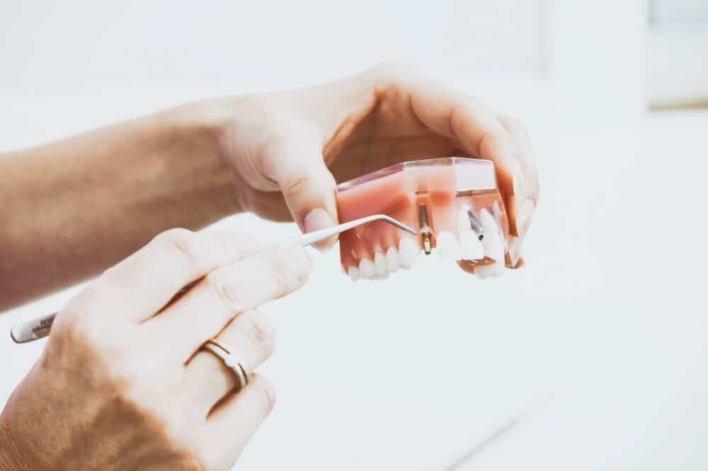 Tooth Replacement Options: Which Is Right For Your Situation?