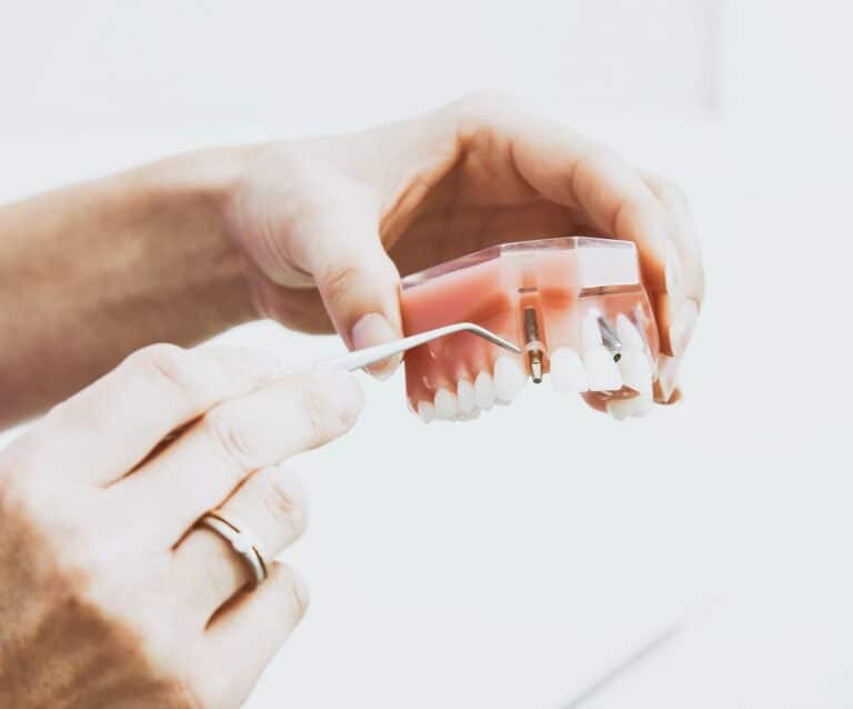 dental implant