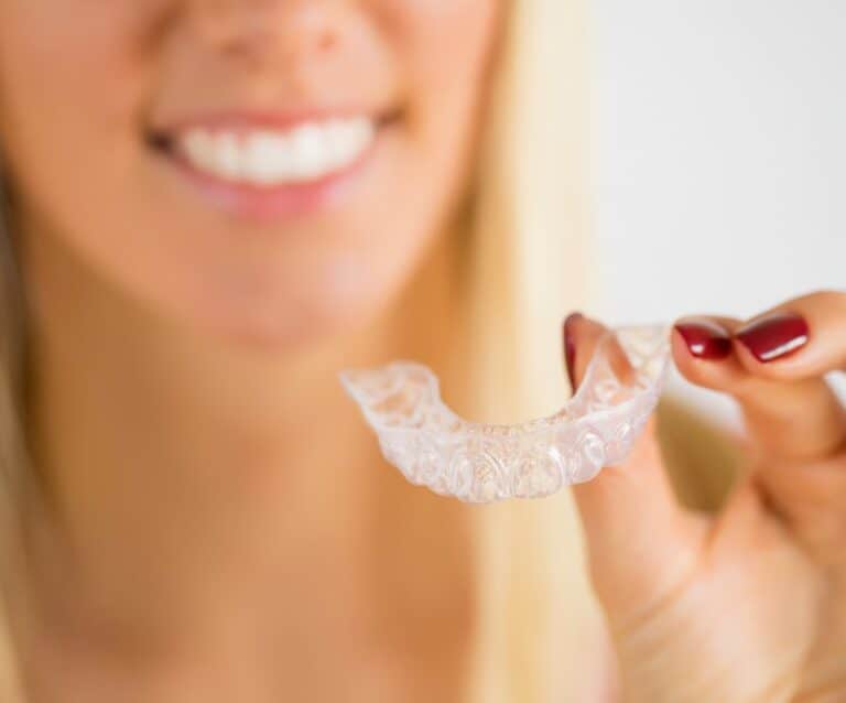 Interesting facts about clear aligners