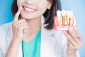 Choosing the Right Dental Implant Specialist